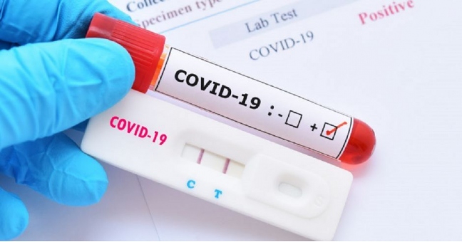 Standar harga tes PCR