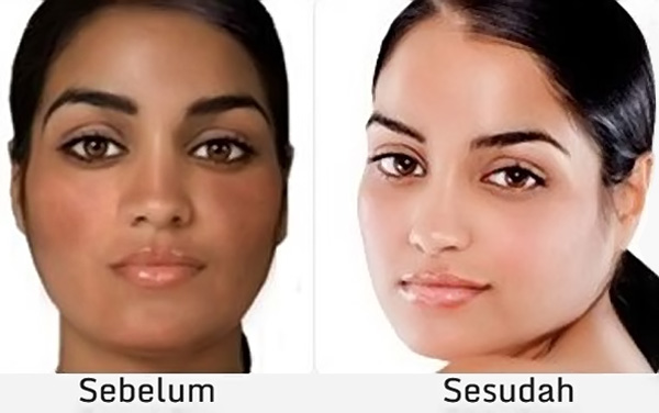 Cara Memutihkan Kulit Wajah atau Tubuh secara Alami